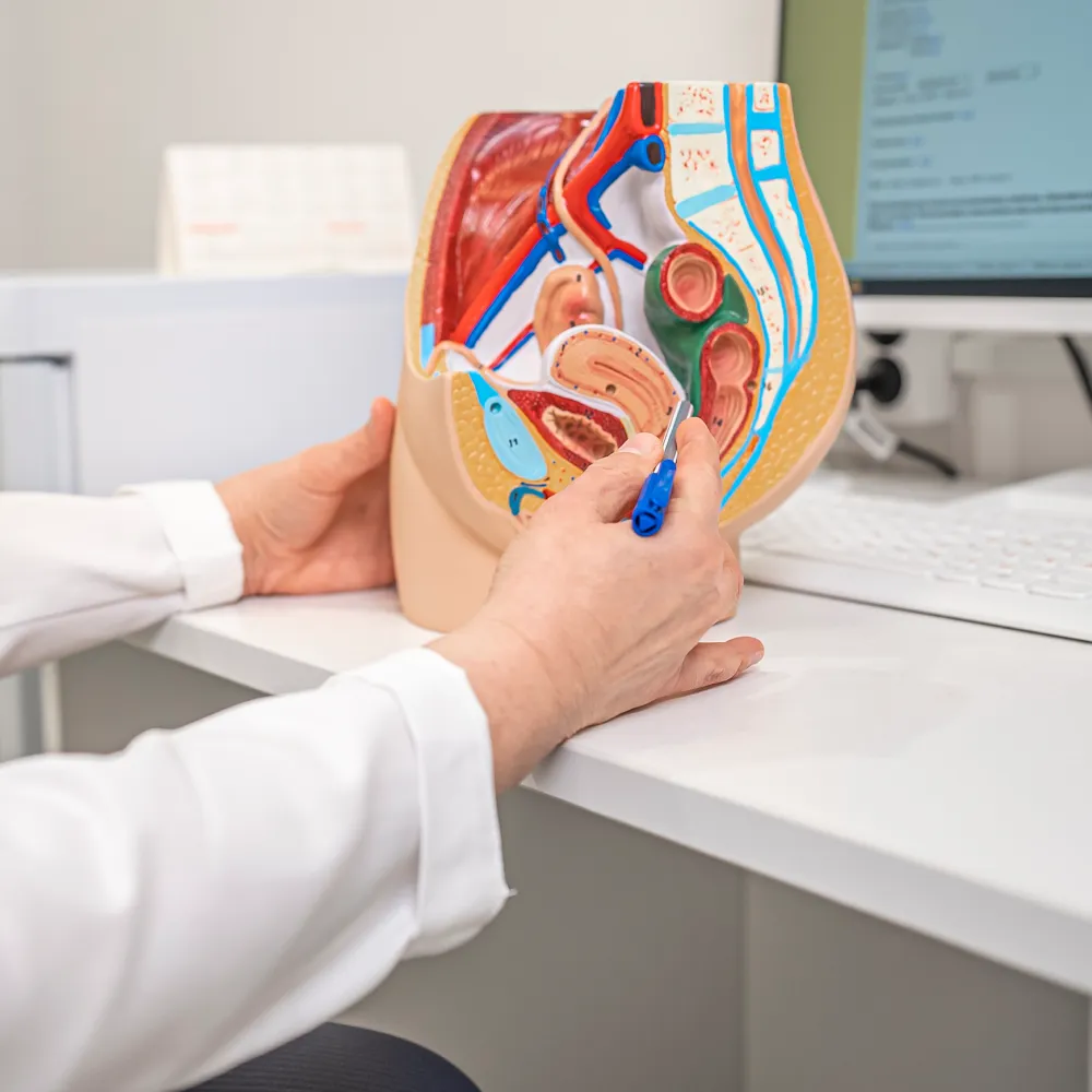 Свищ прямой кишки Свищ прямой кишки