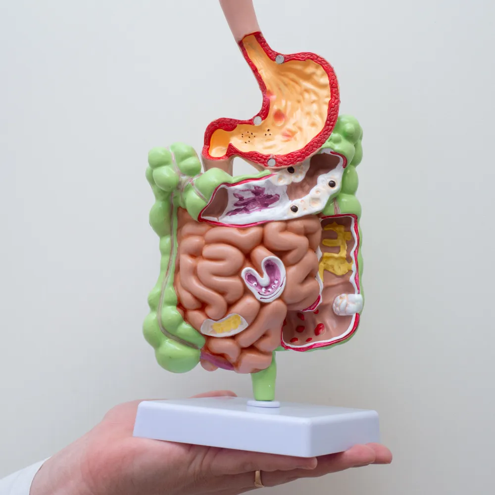 Запор Запор